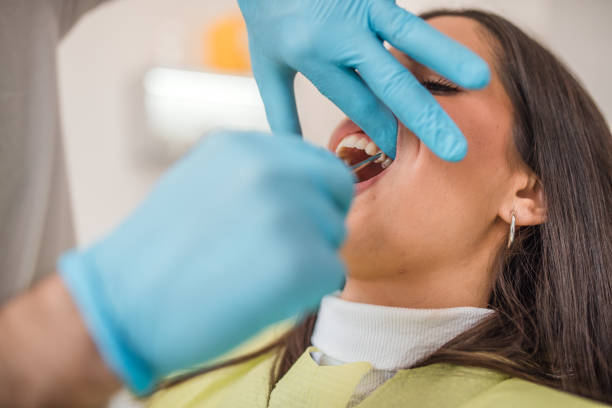 wisdom tooth removal - oral surgery at the dentist