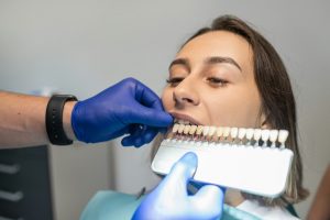 teeth whitening in bellaire tx