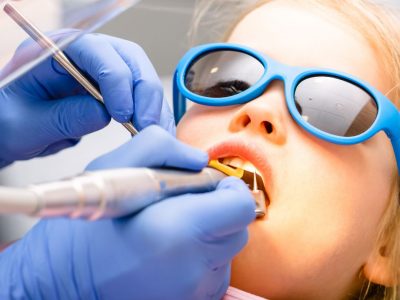 22 pediatric fluoride treatment