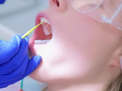fluoride treatment in preventive dentistry