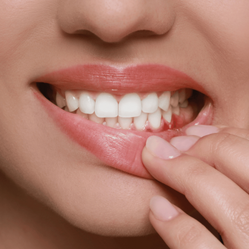 5 Early Signs of Gum Disease (And How to Stop It Before It Gets Worse)