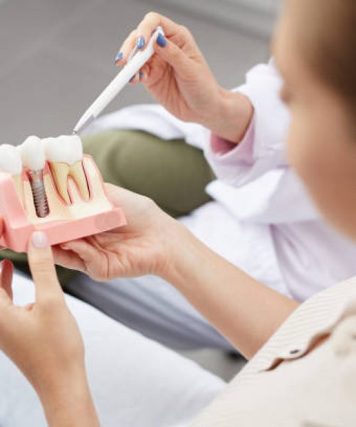 dental implants near me