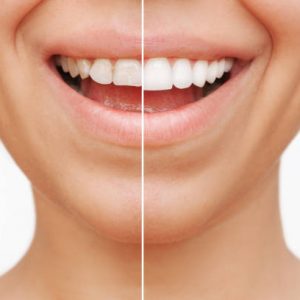 restorative dentistry in bellaire tx
