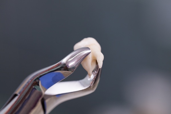 Who Needs A Wisdom Tooth Extraction?